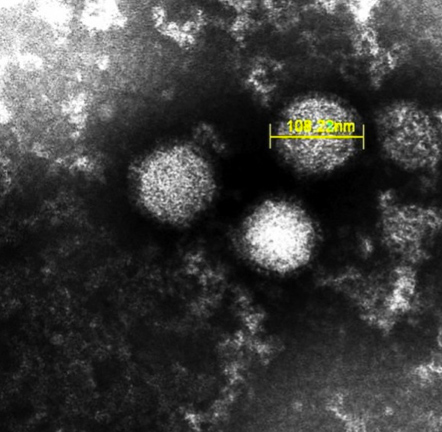 2013年1月に山口県の患者から検出されたSFTSウィルス。直径は1万分の1mm (国立感染症研究所撮影)